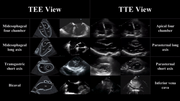 Emergency Medicine Educationultrasound Archives emDOCs Emergency Medicine Educationultrasound Archives emDOCs