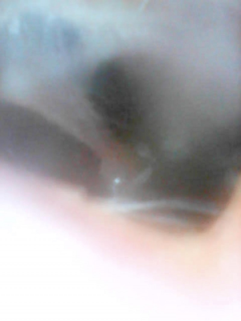 VITCOCO Wireless Otoscope Lets You Look Inside Your Own Ears! {Review