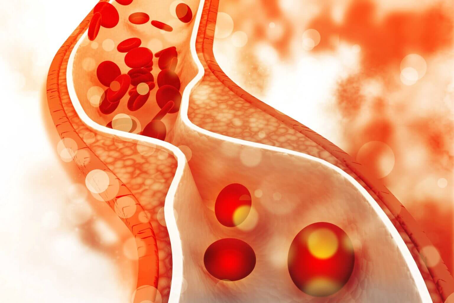 Colesterol HDL vs LDL comparativa con todo lo que debes saber