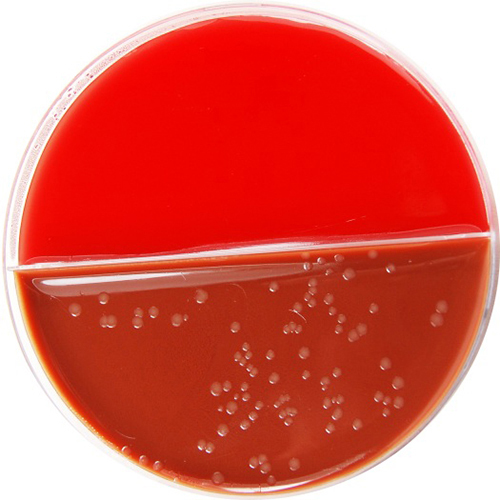 Columbia Agar & Defibrinated Horse Blood / Chocolate Bacitracin Agar