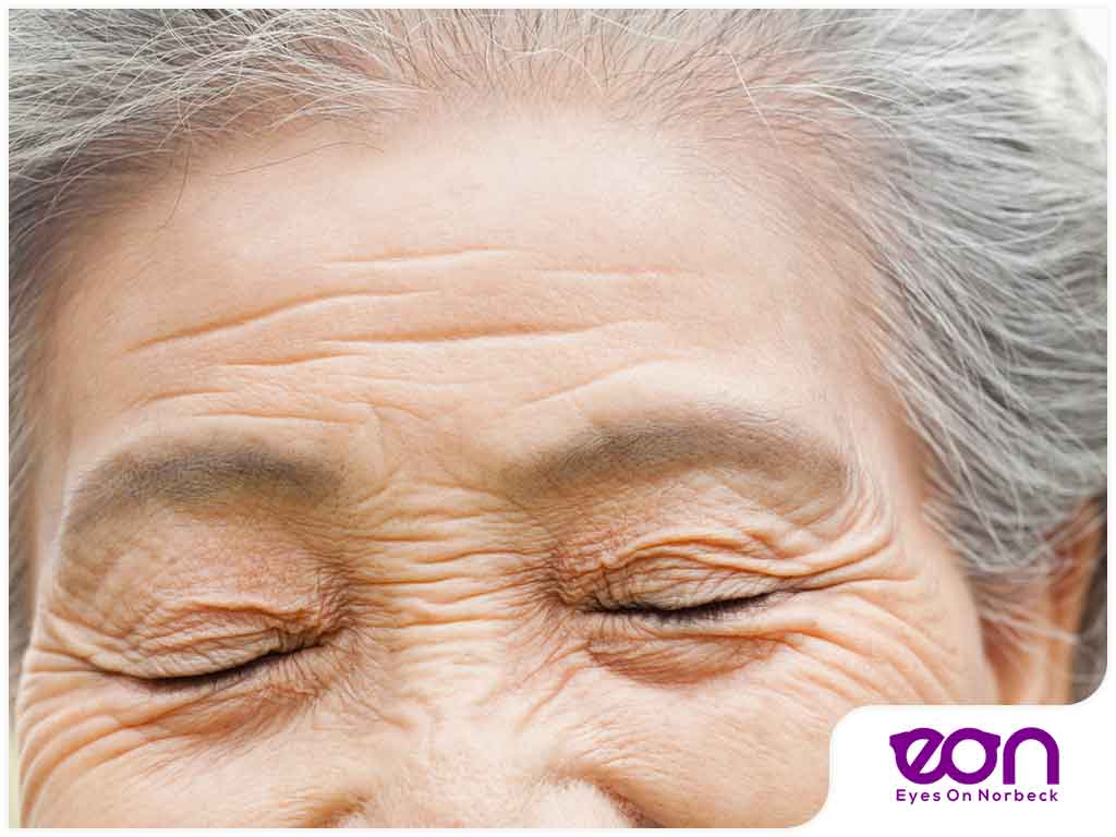 Eyelid Hygiene How to Keep Your Lids Clean and Healthy