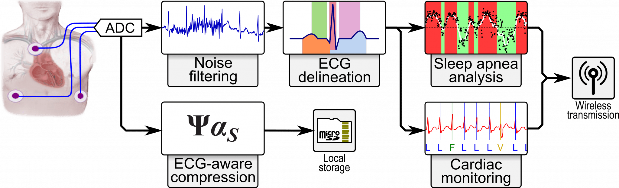 Online Obstructive Sleep Apnea Detection on Wearable Sensors ‒ ESL ‐ EPFL
