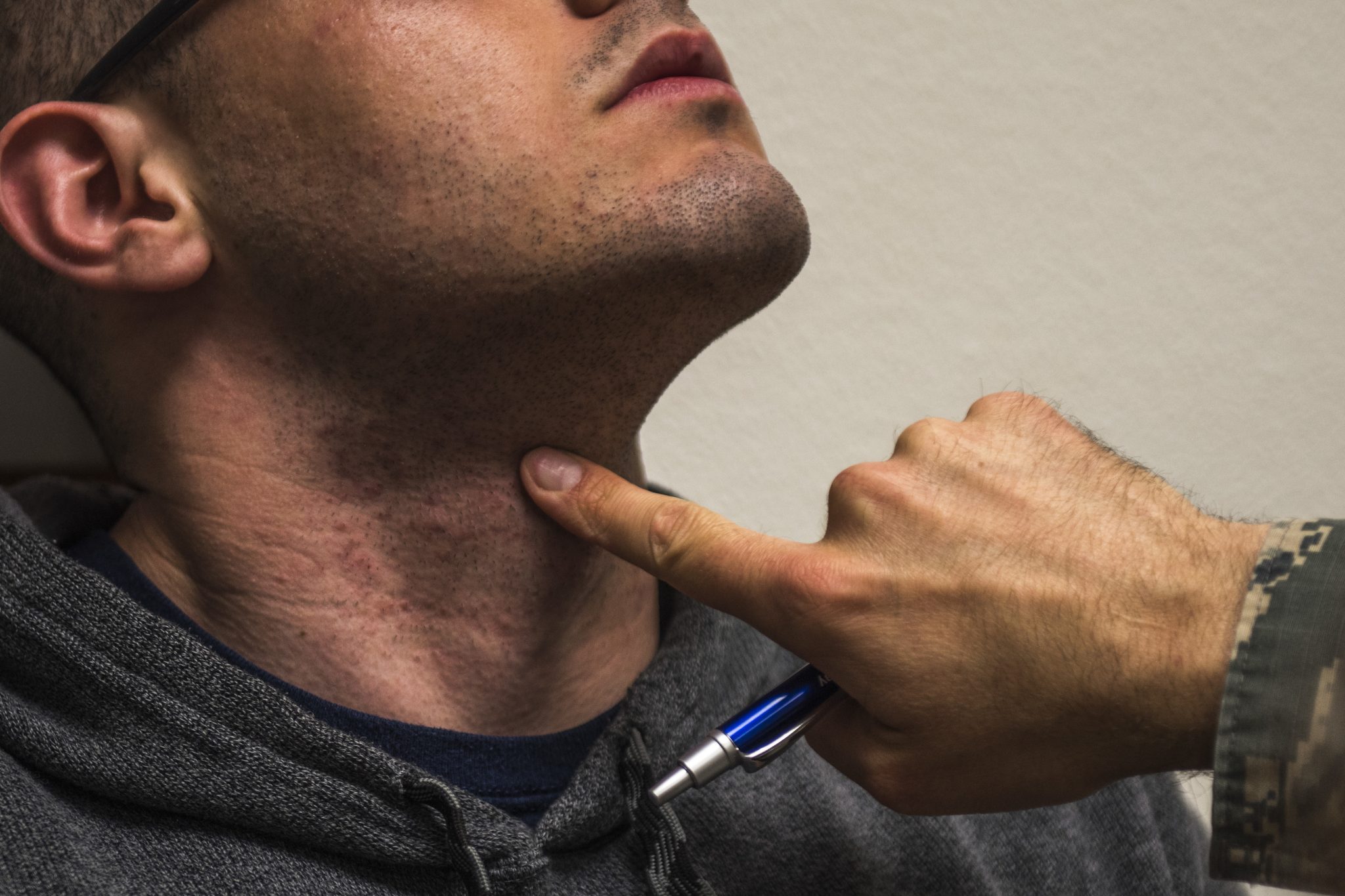 Eliminate Razor Bumps on Your Nexk