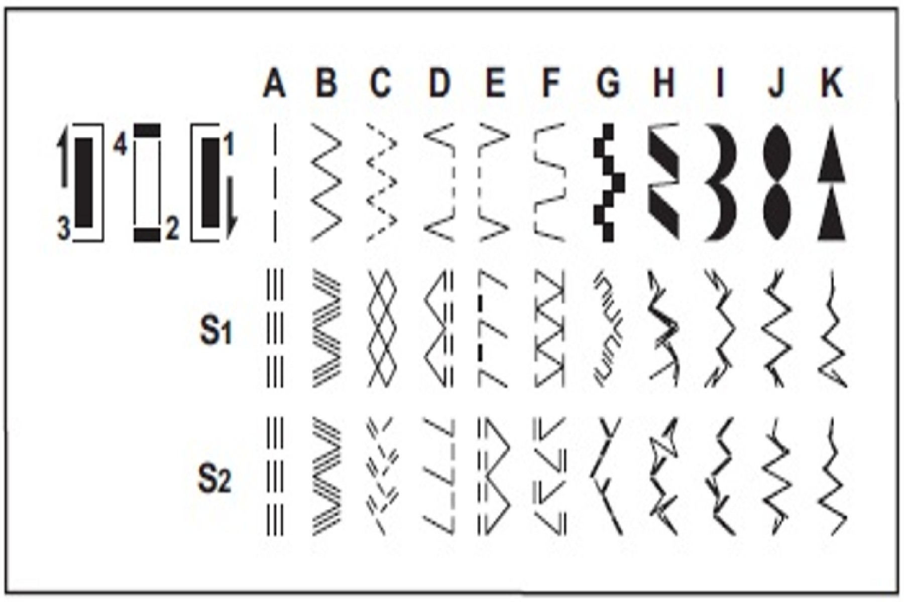 Sewing Machine Stitches Guide