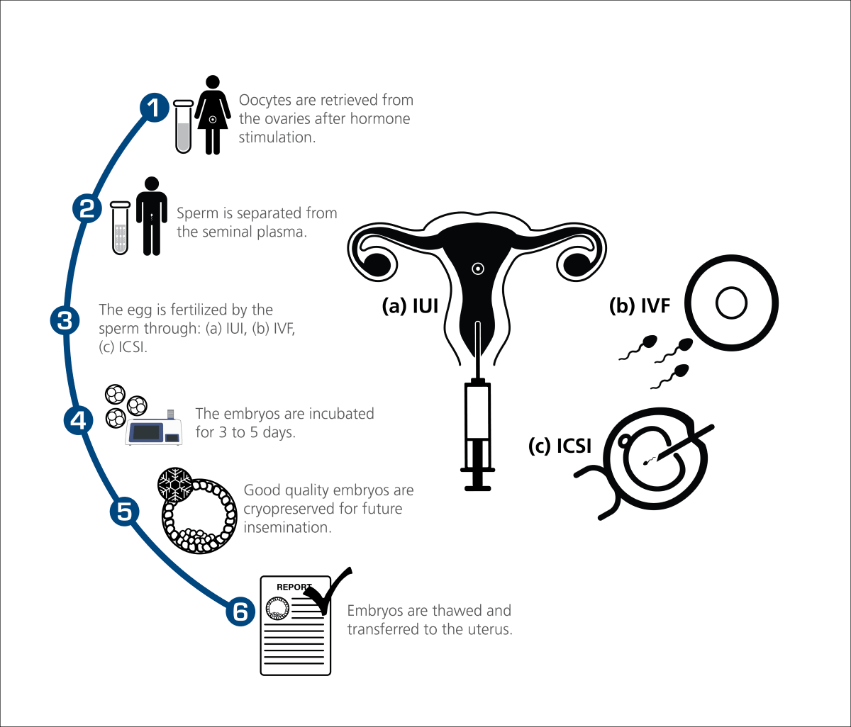 The role of MIRI Multiroom incubators during IVF Esco Medical