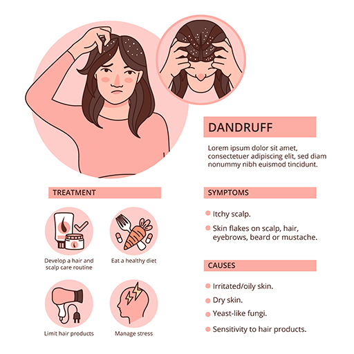 How to Get Rid of Dandruff? Eshaistic Blog