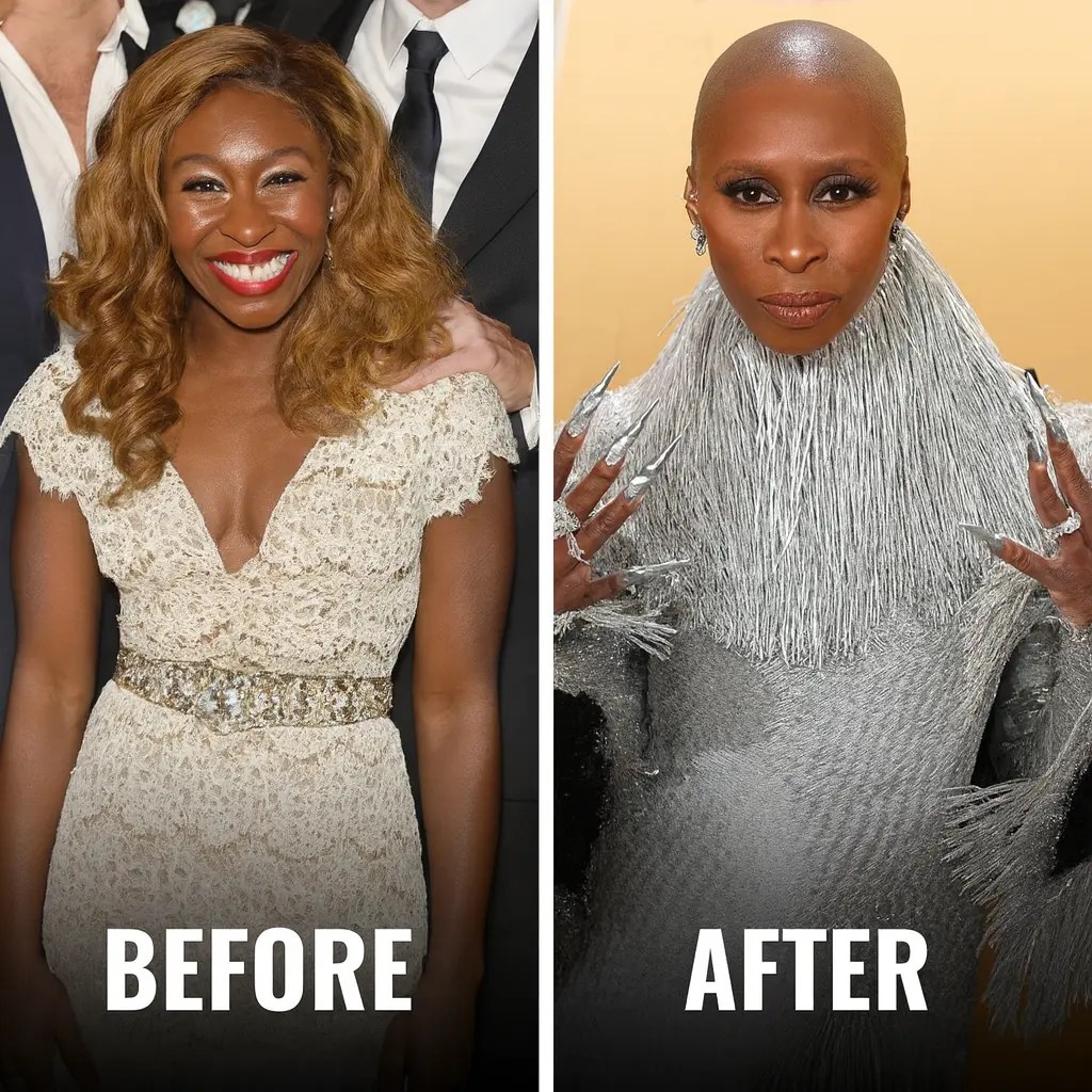 Why Does Cynthia Erivo Have No Hair or Eyebrows? Understanding the