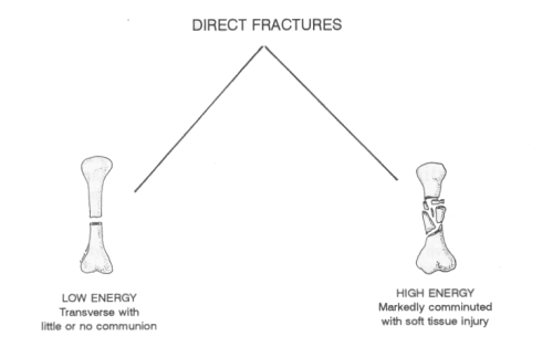 Arm And Leg Injury Mechanisms