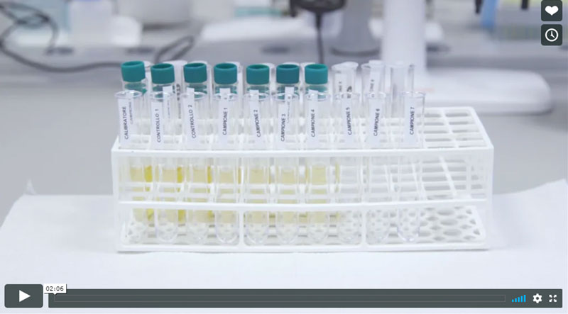 AbstractDosage of catecholamines in urine and in plasmaPart II