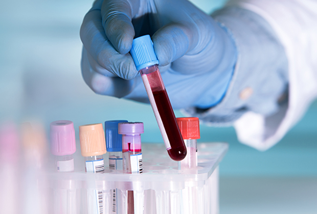 Home Visit For Blood Test in Dombivli (Call 9820417230) Eureka