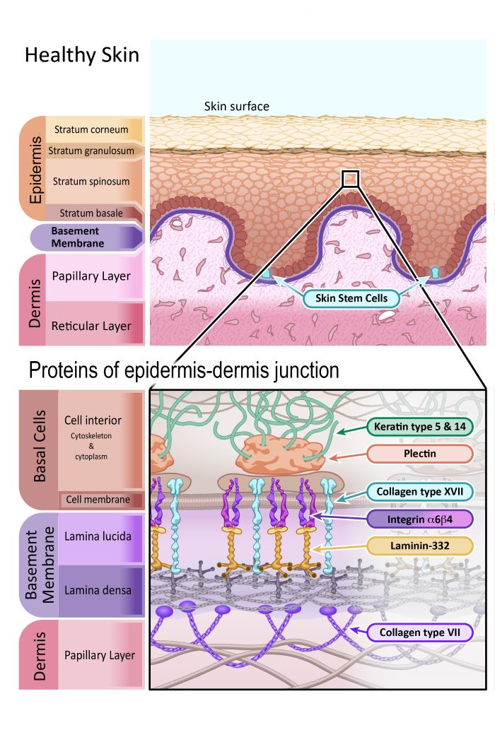 Epidermolysis Bullosa How could gene and cell therapy help? EuroGCT