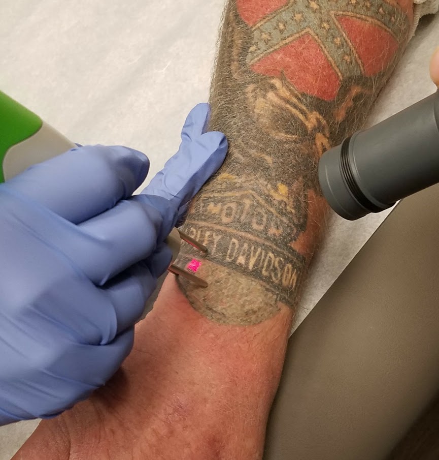 laser tattoo removal wichita ks Evicted Ink