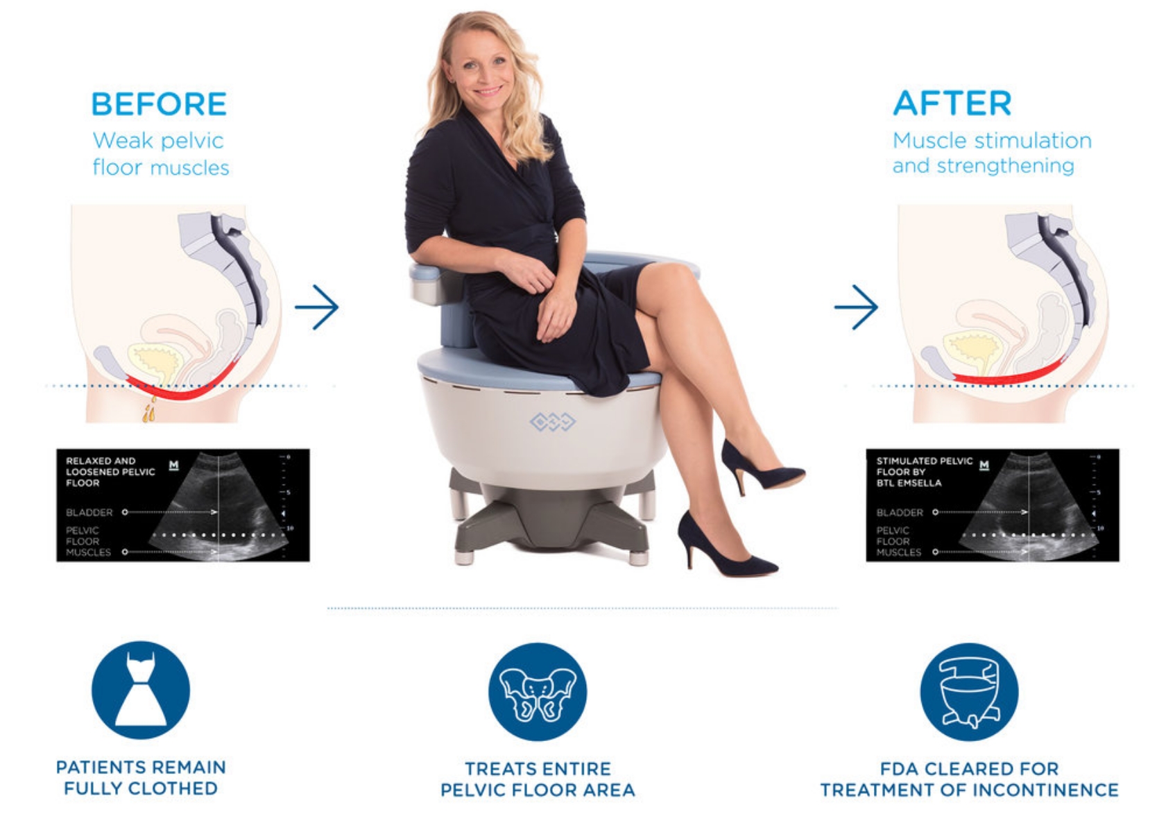 Incontinence Solution Emsella Chair
