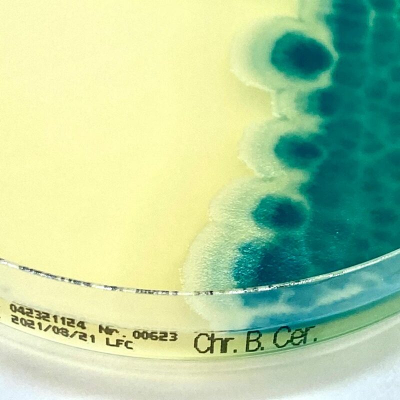 Chromatic Bacillus cereus EWC Diagnostics