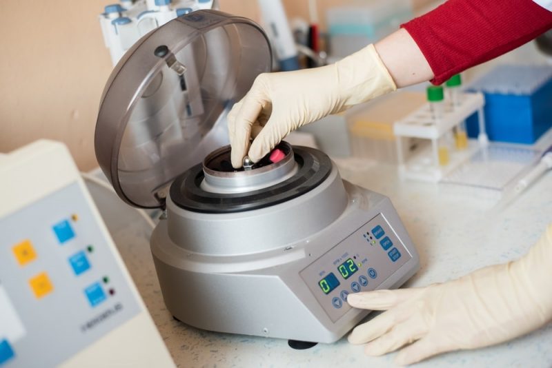 15 Examples of Centrifugation Examples Lab