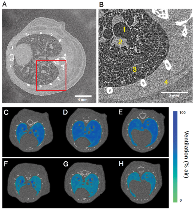 Phasecontrast imaging Excillum