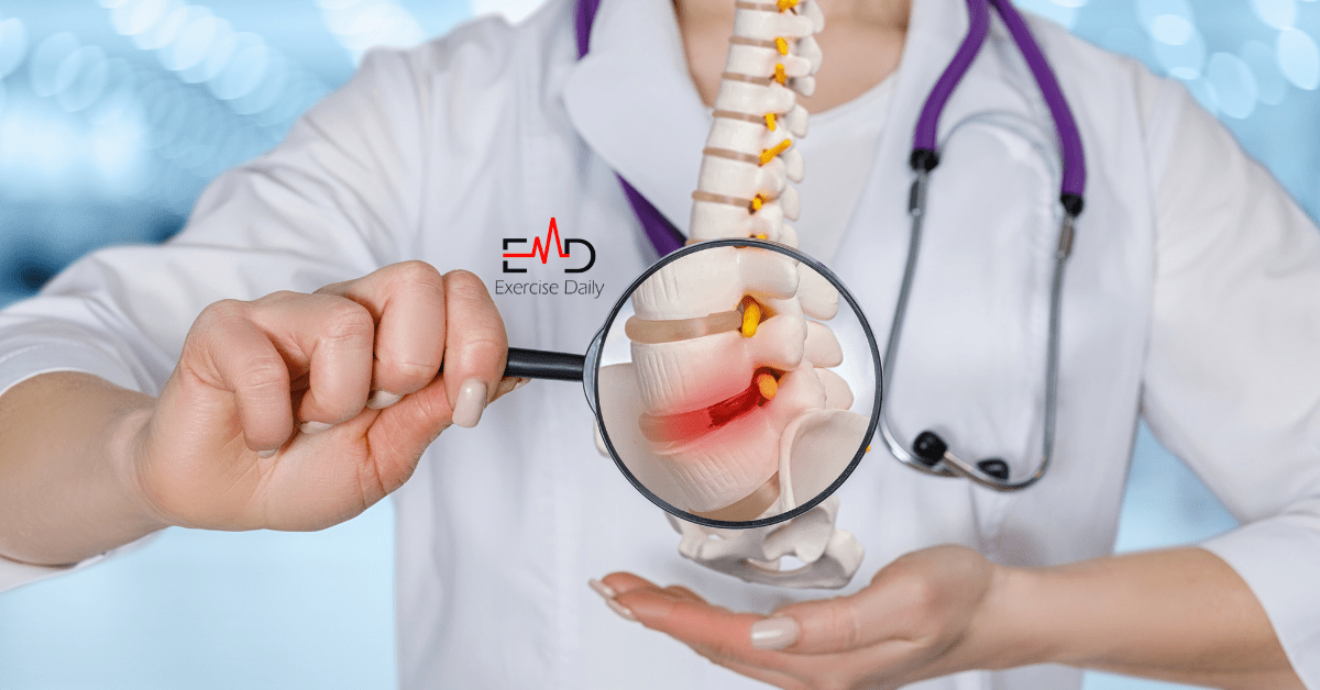 Sports Hernia Surgery Treatment and Causes (2023)