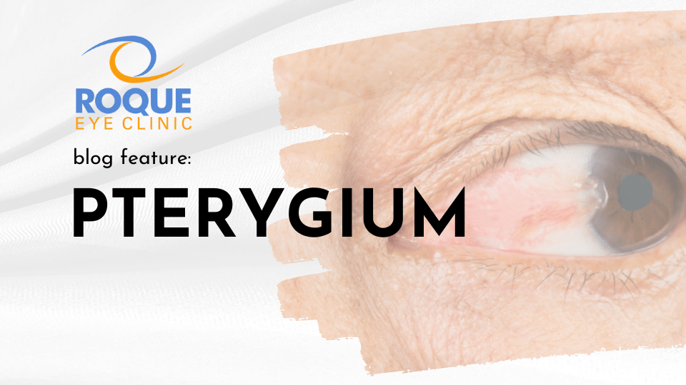 Advanced Pterygium Excision ROQUE Eye Clinic