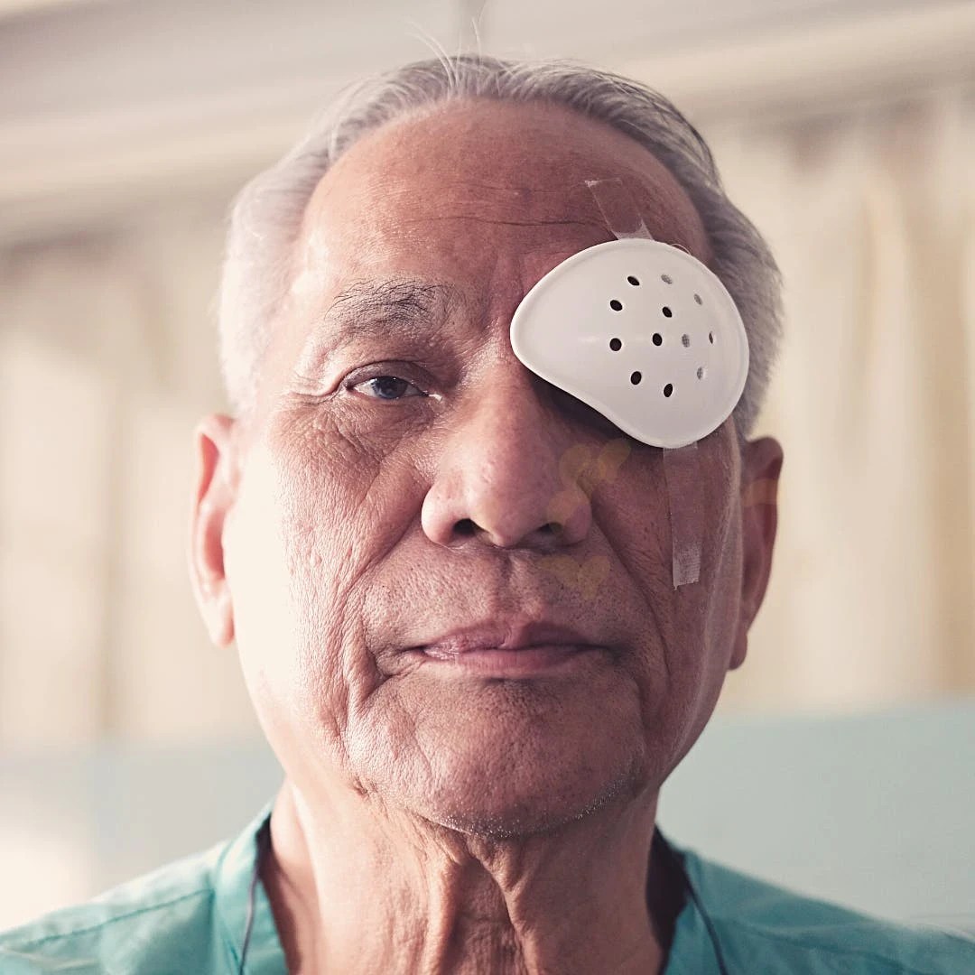Sleeping Position After Cataract Surgery eyeFACTS