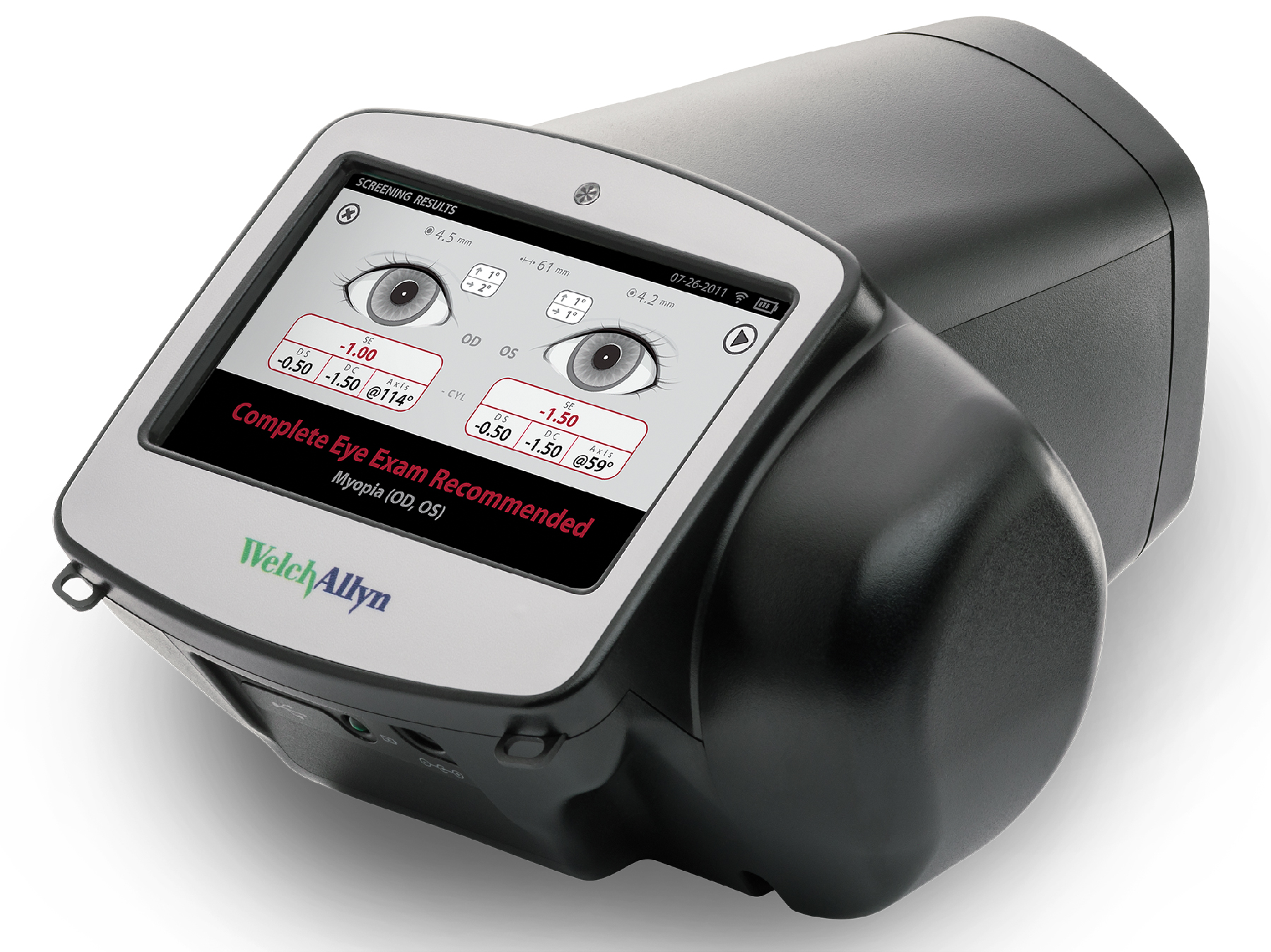 Vision Screening for Amblyopia