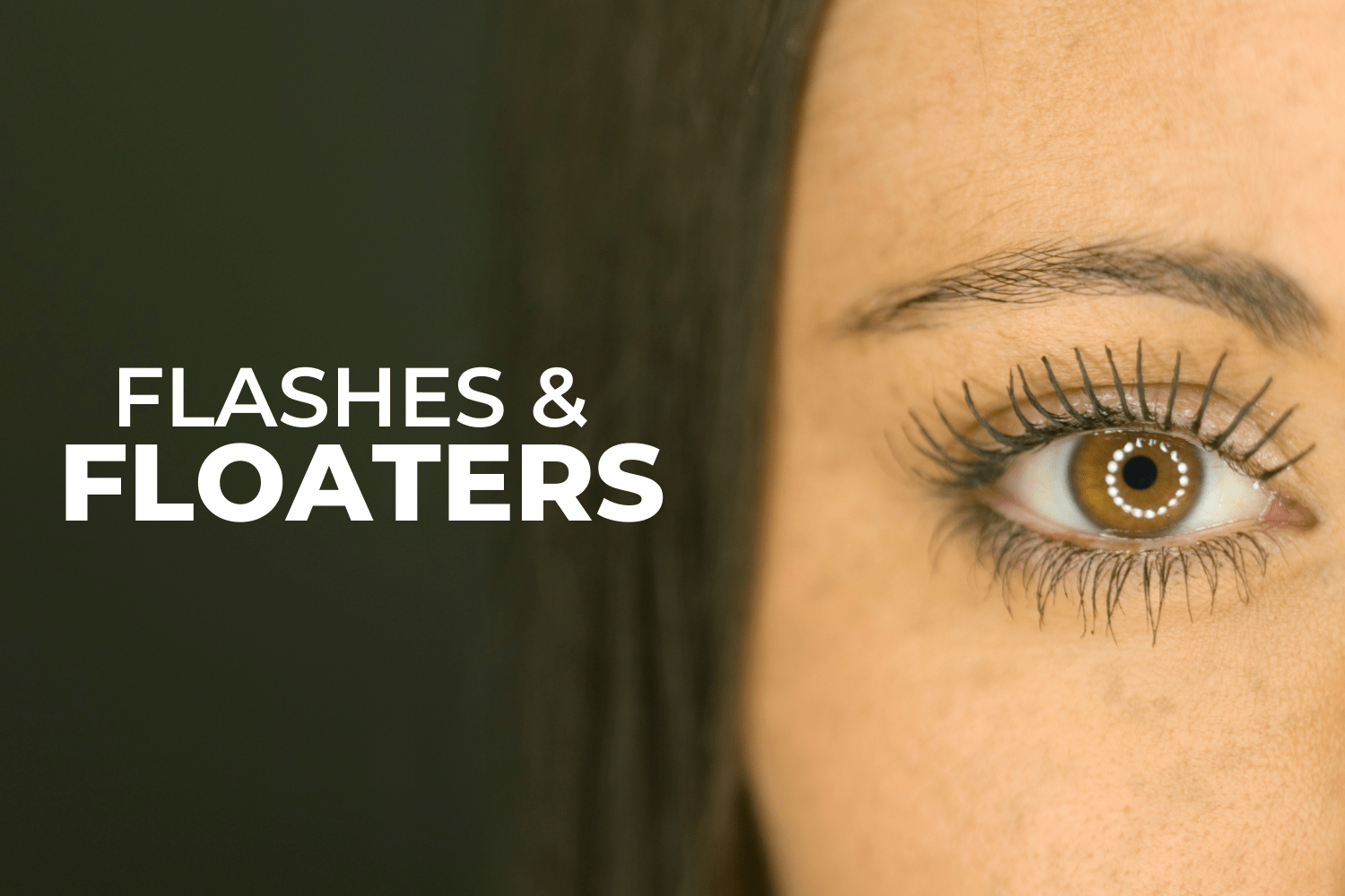 Should You Worry About Eye Flashes and Floaters? EZOnTheEyes