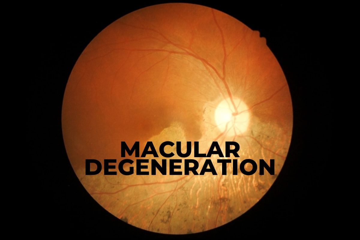 Are You at Risk for Macular Degeneration? EZOnTheEyes