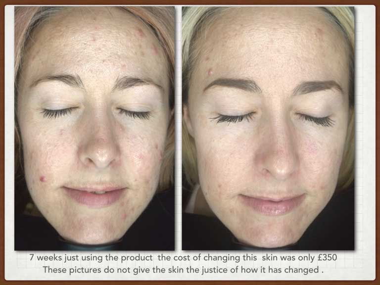 Exclusive to FaceIt Face It London