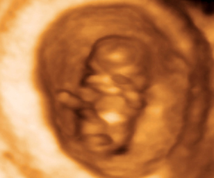 You Are 9 Weeks And 3 Days Pregnant - Familyeducation