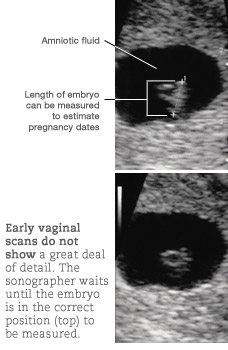 You Are 5 Weeks And 1 Day Pregnant - Familyeducation