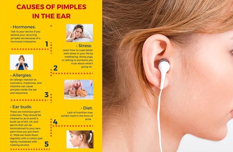 Amazing Ways To Get Rid of Pimple inside Ear