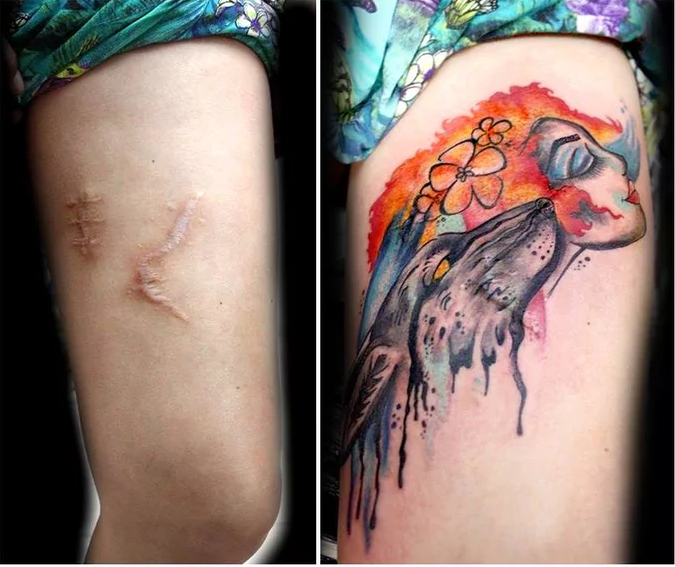 Depois da mastectomia 20 ideias de tattoos para cobrir a cicatriz da Lindas tatoos feitas para cobrir cicatrizes