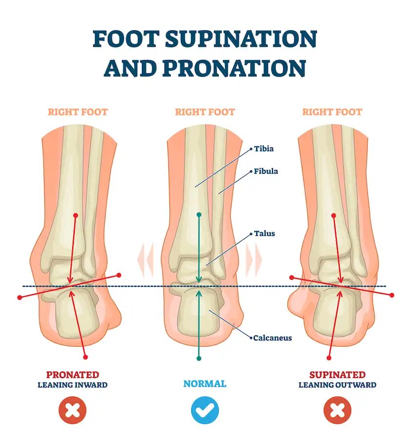 6 Best Exercises To Correct Foot Supination Feel Good Life
