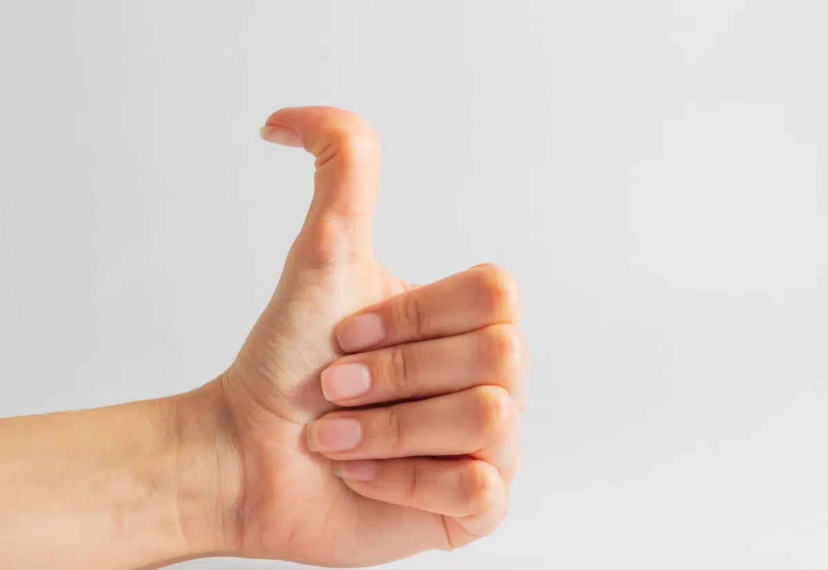 Best Strengthening Exercises For Managing Hypermobility