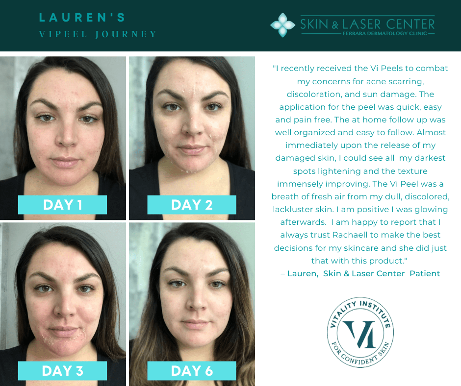 VI Peel Ferrara Dermatology