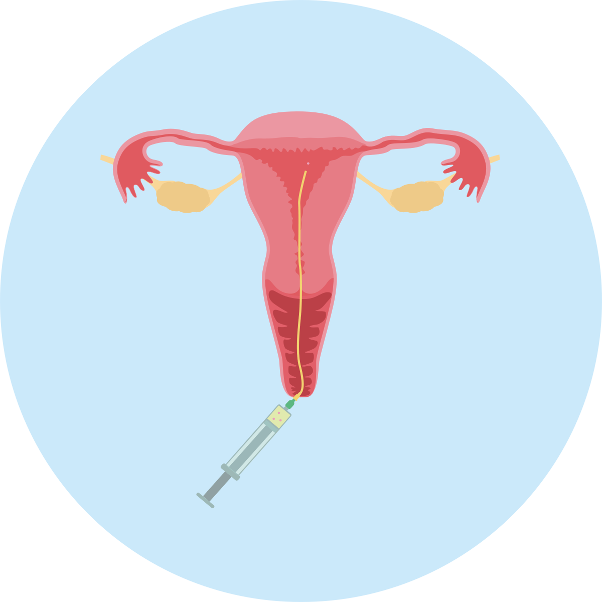 IVF process how does IVF work? Fertility Specialists Perth