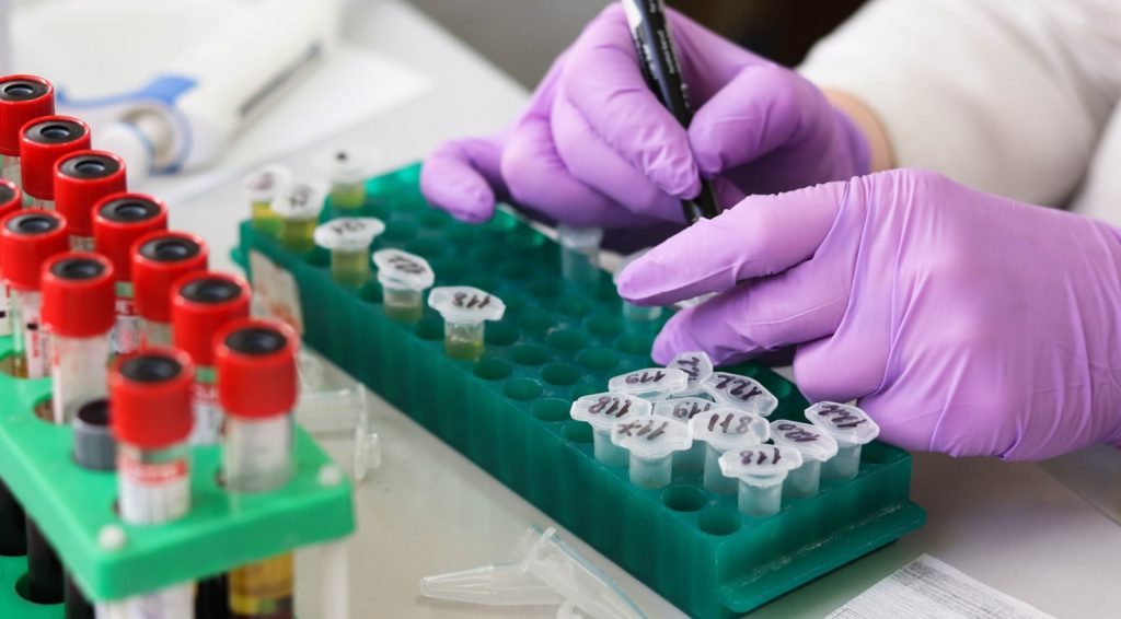 Innovación test en sangre detectara en 20 minutos la tuberculosis en