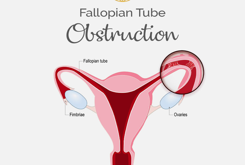 What is the cause of blocked fallopian tubes? Fibroid Treatment Clinic