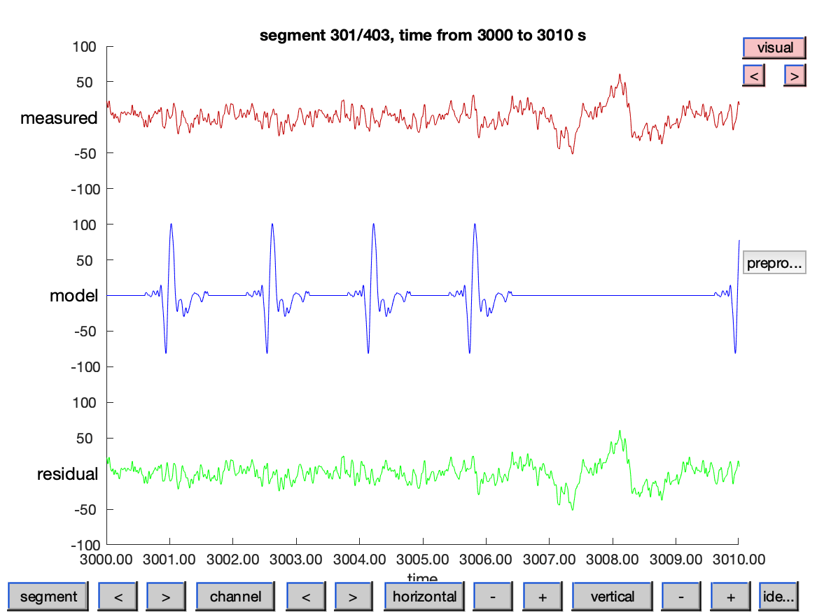 Using General Linear Modeling on time series data FieldTrip toolbox