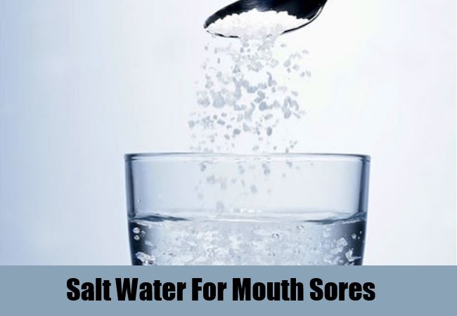 11 Home Remedies For Mouth Sores Natural Treatments & Cure For Mouth