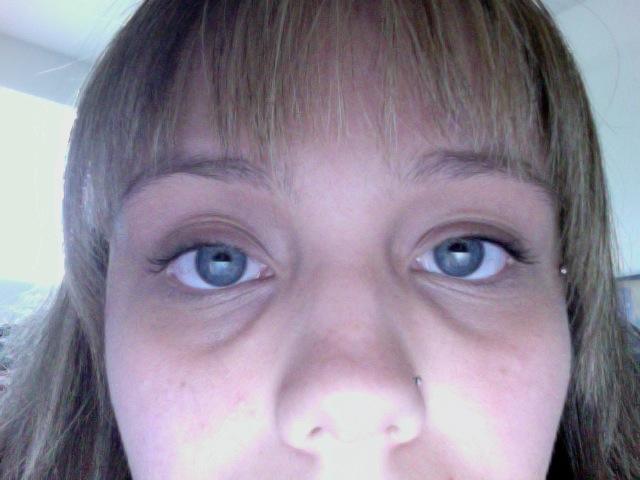 Vitamin D Deficiency And Dark Circles Under Eyes Creativmakeup.co