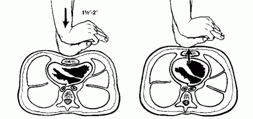 First aid Triage First Aid for Free