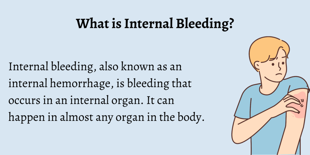 First Aid For Internal Bleeding First Aid for Free