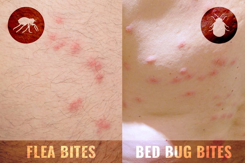 Flea Bites vs Bed Bug Bites What is the Difference? FLEABITES