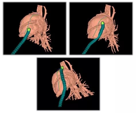 What Is Simultaneous Localization And Mapping (Slam)?