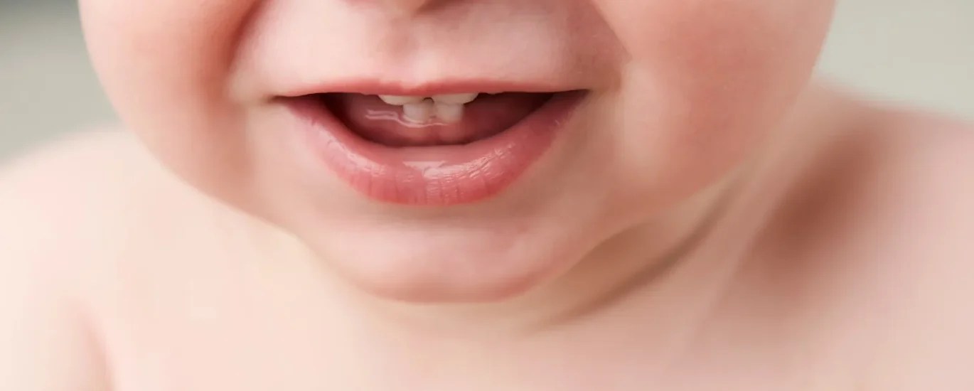 Gentle Battles for Happy Grins The Competitive Landscape of Baby