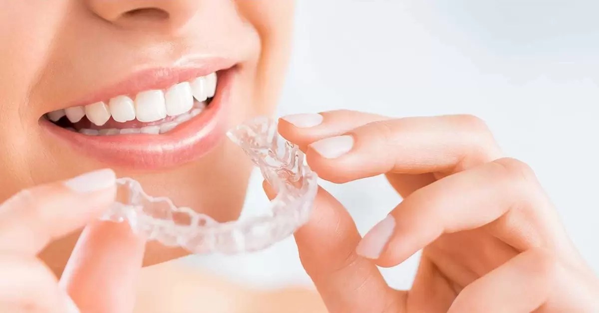 FMS DENTAL HOSPITALS Best Dental Clinic for Dental Implant with Top