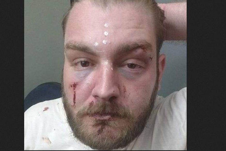 Policiais militares são afastados após quebrarem braço de petista em delegacia