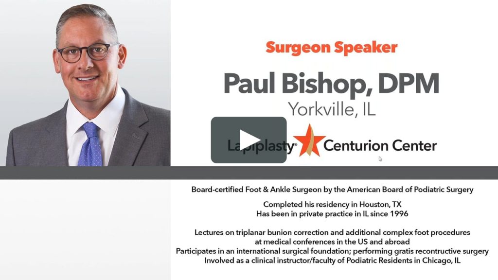 Bunions in Yorkville & Morris, IL Foot and Ankle Centers