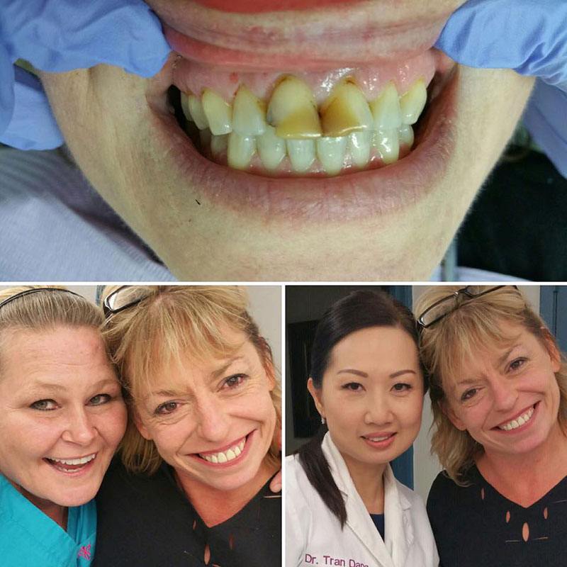 Gallery Dentist in Azle & Decatur, TX