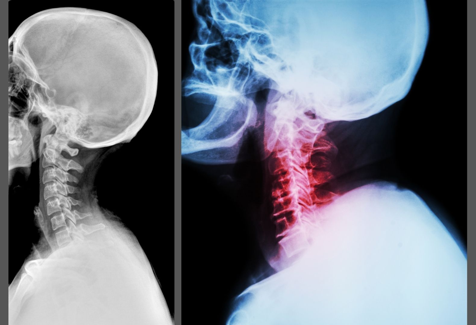 What to do if you have lost the curve in your neck Free Body Now